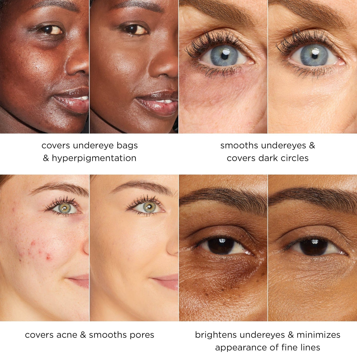 Final 3 Hours: 60% OFF🔥Blur Concealer Stick