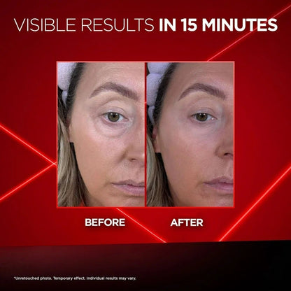 🏆Flash Sale⚡ 50K+ SOLD! Almost Gone-💥🔥Revitalift Laser Eye Bag Instant Eraser