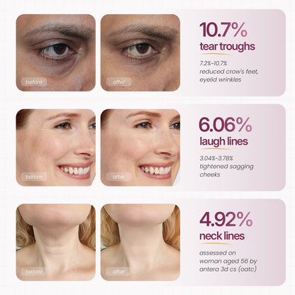 Cemenrete Calcium Multi Balm | Anti-aging, Sagging, Wrinkles