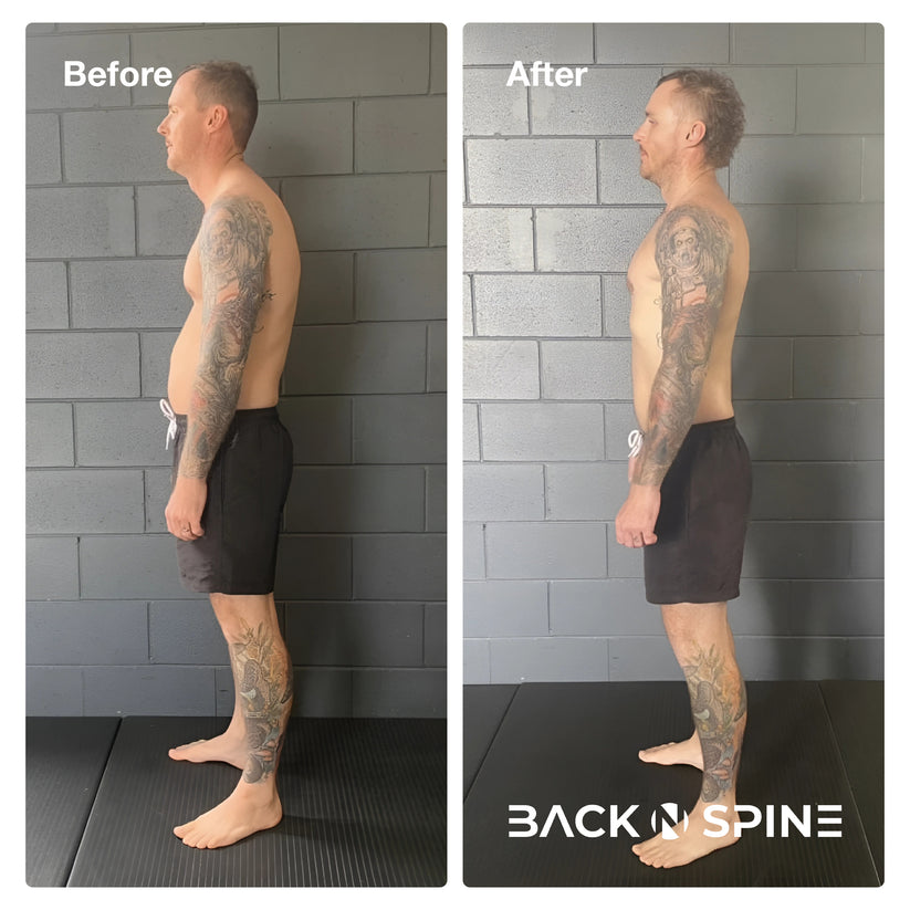 Original Back HeroPosture Corrector