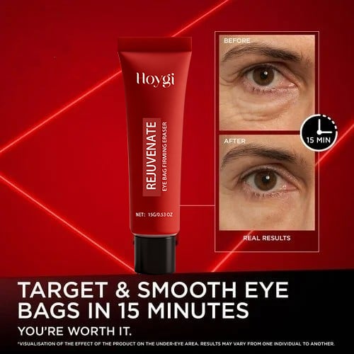 🏆Flash Sale⚡ 50K+ SOLD! Almost Gone-💥🔥Revitalift Laser Eye Bag Instant Eraser