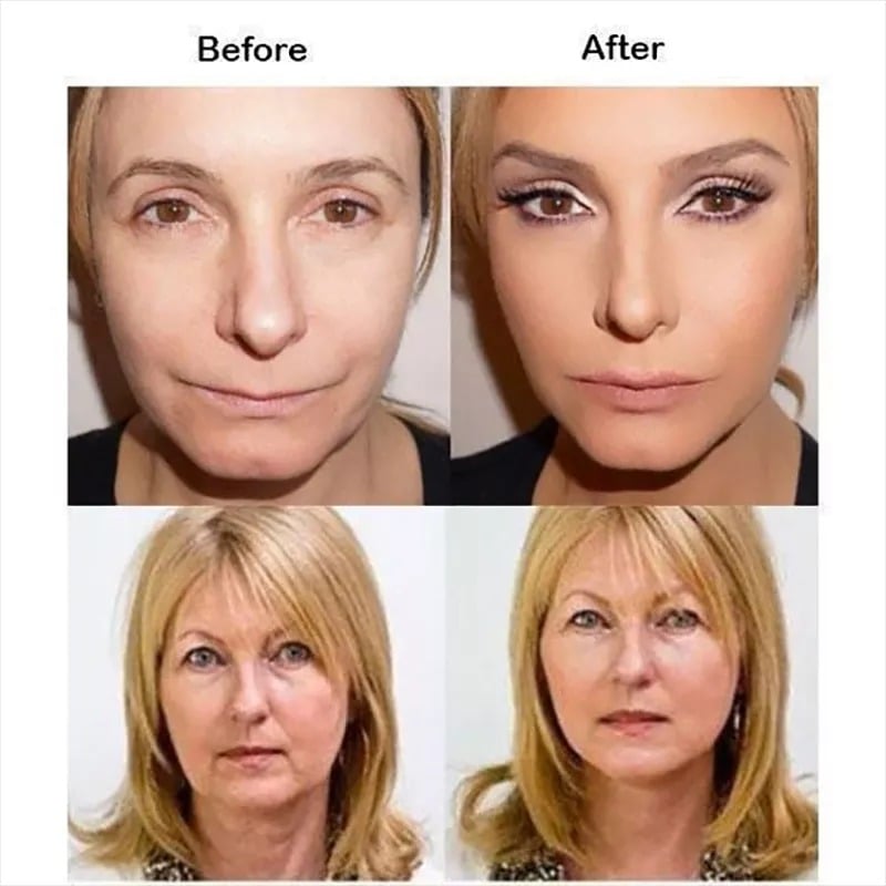 Buy 1 Get 1 Free 49%OFF🔥New Ultra Invisible Waterproof Face Lift Stickers Complete Kit