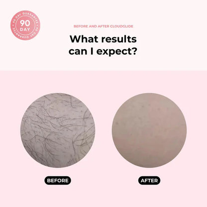 SilkGlide Pro™  2 in 1 Shaver